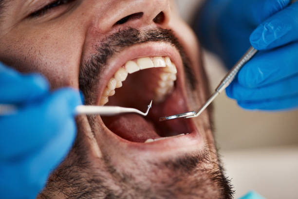 Best Weekend Emergency Dentist in Port Royal, SC