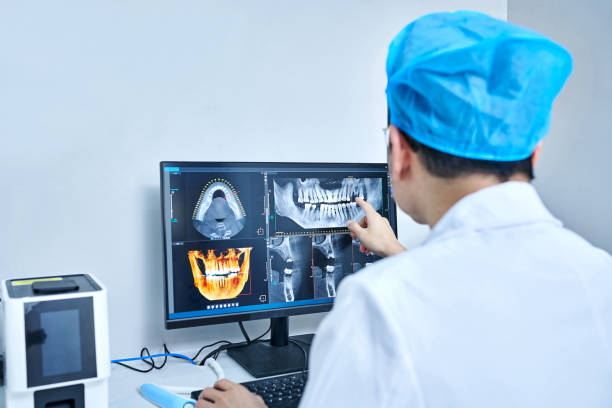 Best Emergency Wisdom Teeth Removal in Port Royal, SC